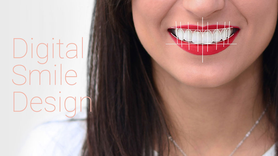 Digital Smile Design