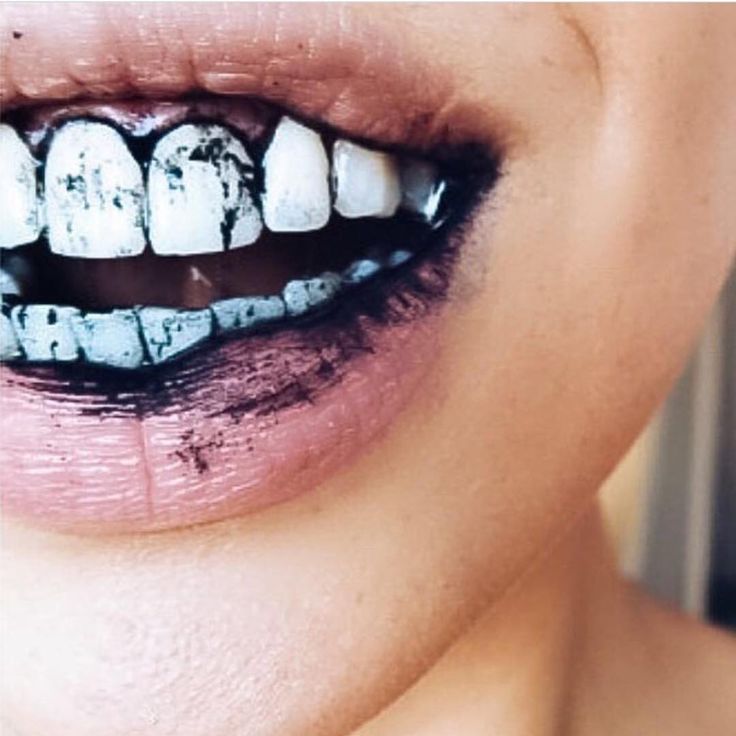 Charcoal teeth whitening
